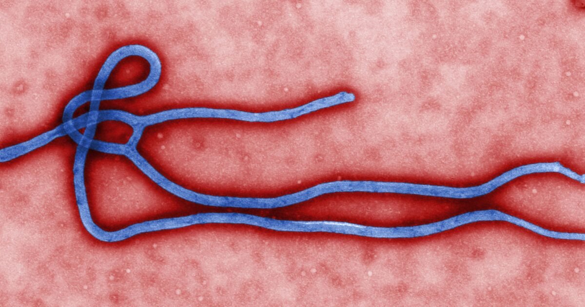Ebola_virus_virion