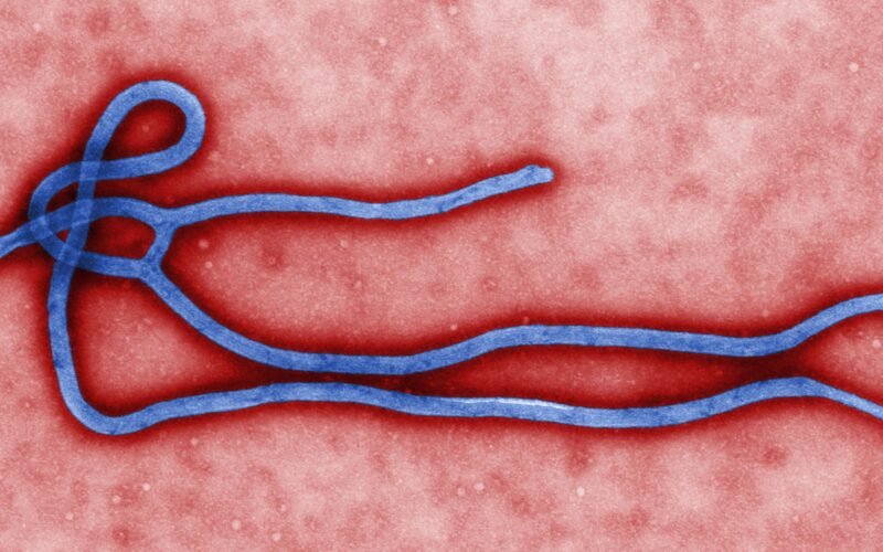 Ebola_virus_virion