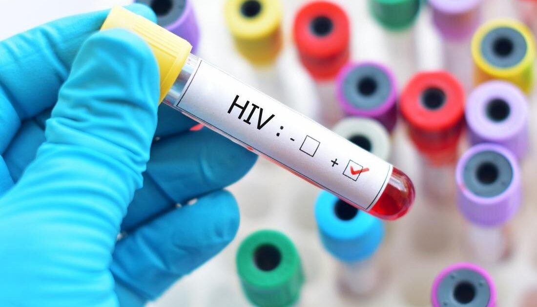 Illustrative HIV blood-test image for a report about the AIDS 2026 conference