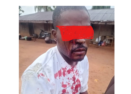 Ebonyi Police Detain Officers Over Alleged Assault Of Civilian